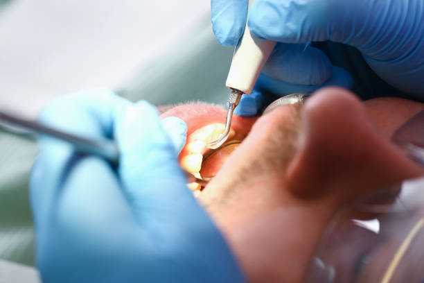 Best Emergency Treatment for Jaw Pain or Injury in Fulton, NY